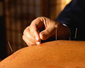 Best Acupuncture in Phoenix and Scottsdale